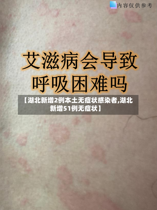 【湖北新增2例本土无症状感染者,湖北新增51例无症状】