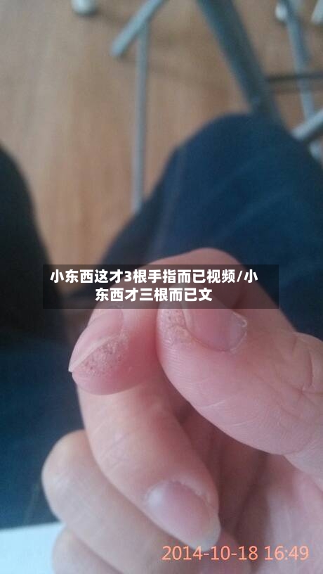 小东西这才3根手指而已视频/小东西才三根而已文
