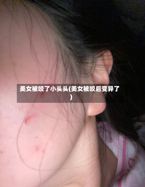 美女被咬了小头头(美女被咬后变异了)-第2张图片