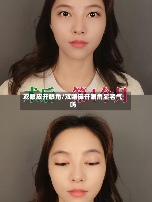 双眼皮开眼角/双眼皮开眼角显老气吗-第2张图片